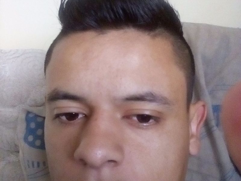 El aumento del pene la distensión