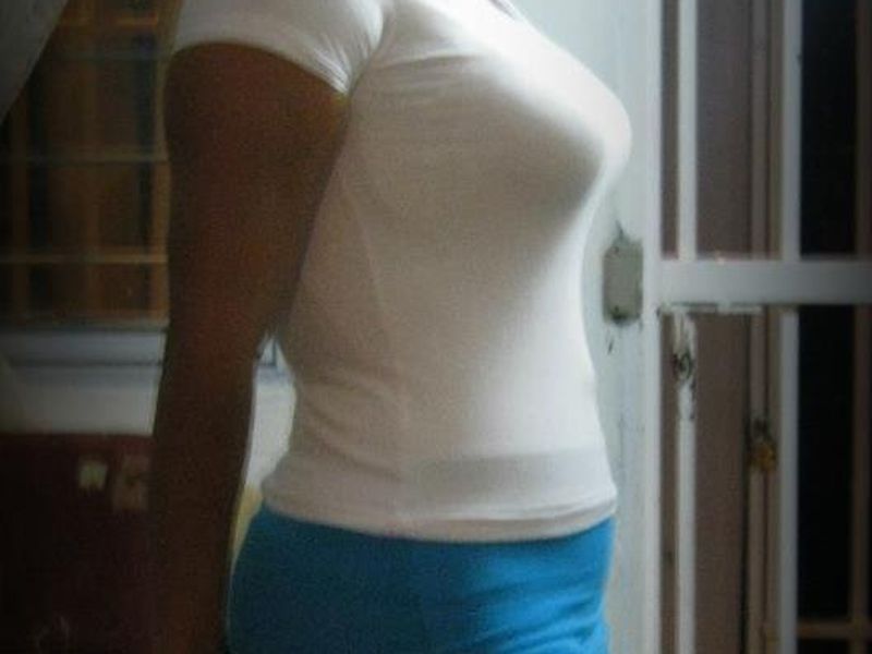 Los granos sobre la persona y el cuerpo de la causa y el tratamiento